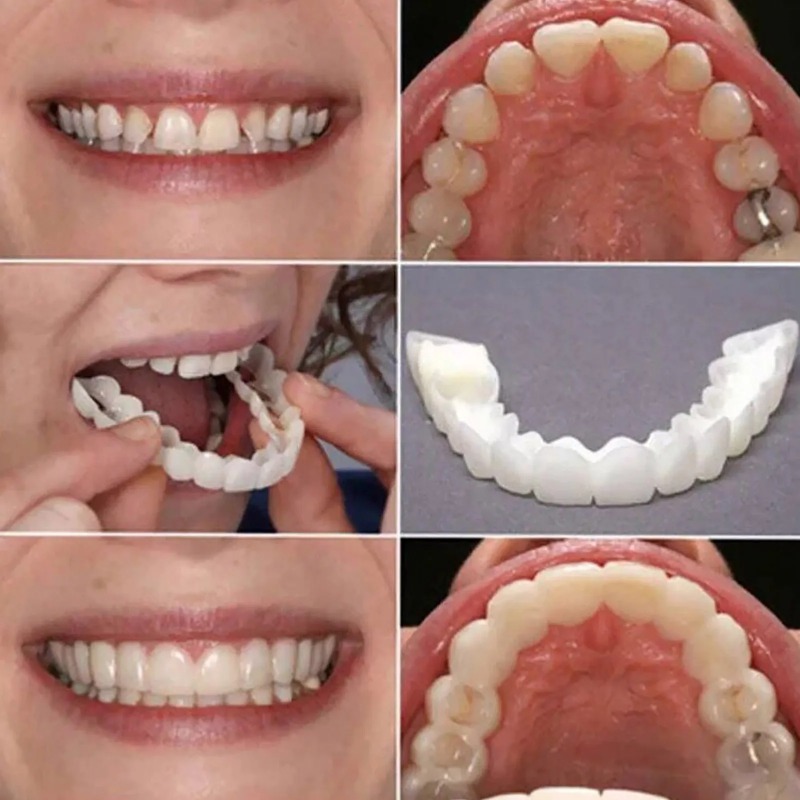 Teeth Whitening For Braces - Instant Smile Whitening Teeth Veneers Reusable