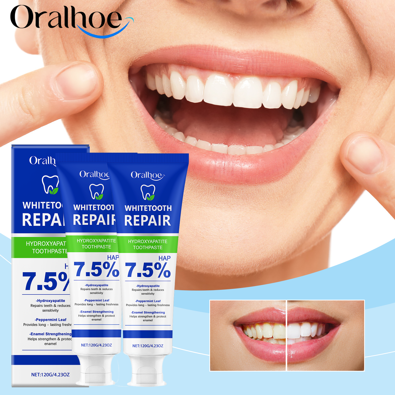 Teeth Whitening Toothpaste - Oralhoe Nicotinamide Whitening Toothpaste Mint Plaque