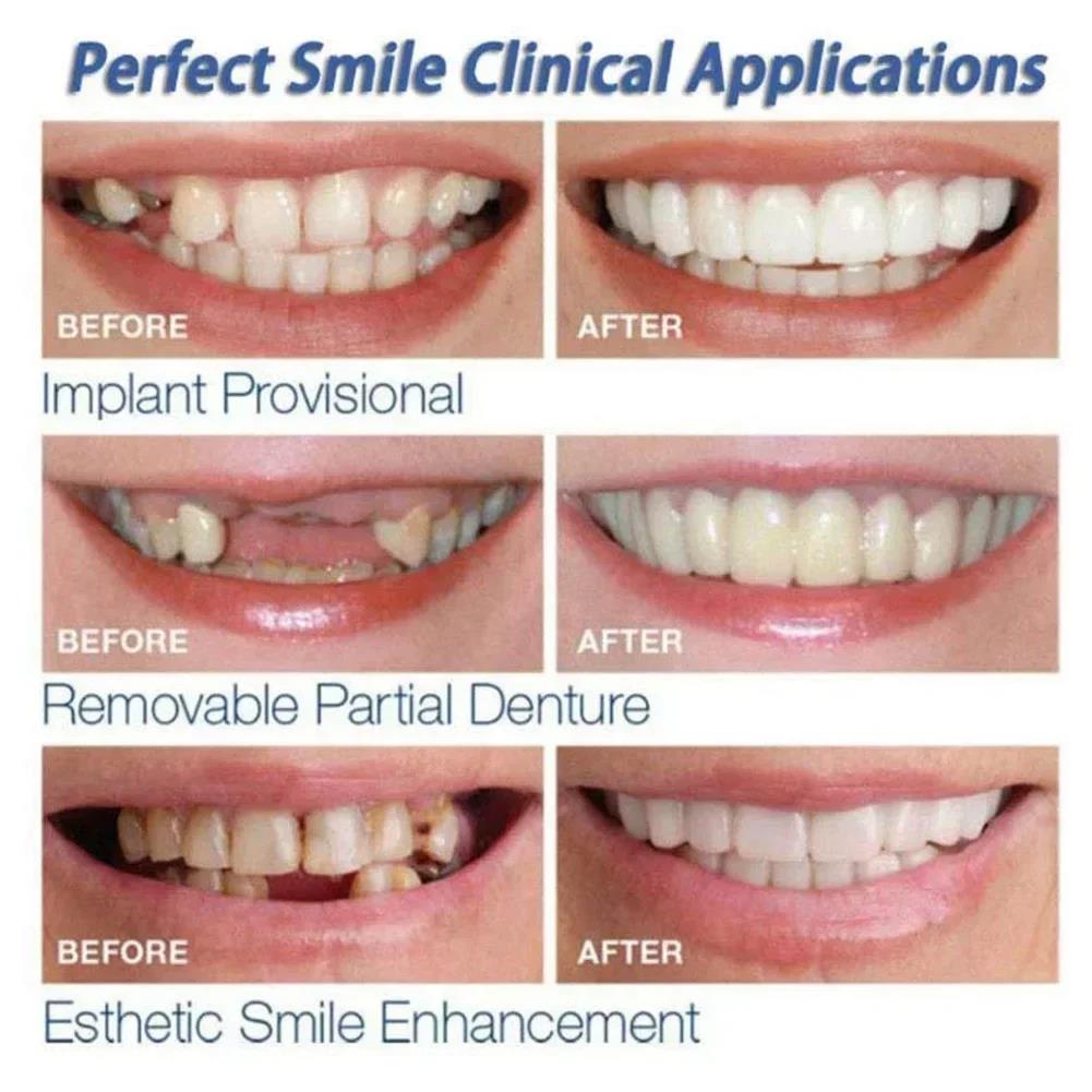 Teeth Whitening Session - Best Sellers Teeth Kit Fake Temporary
