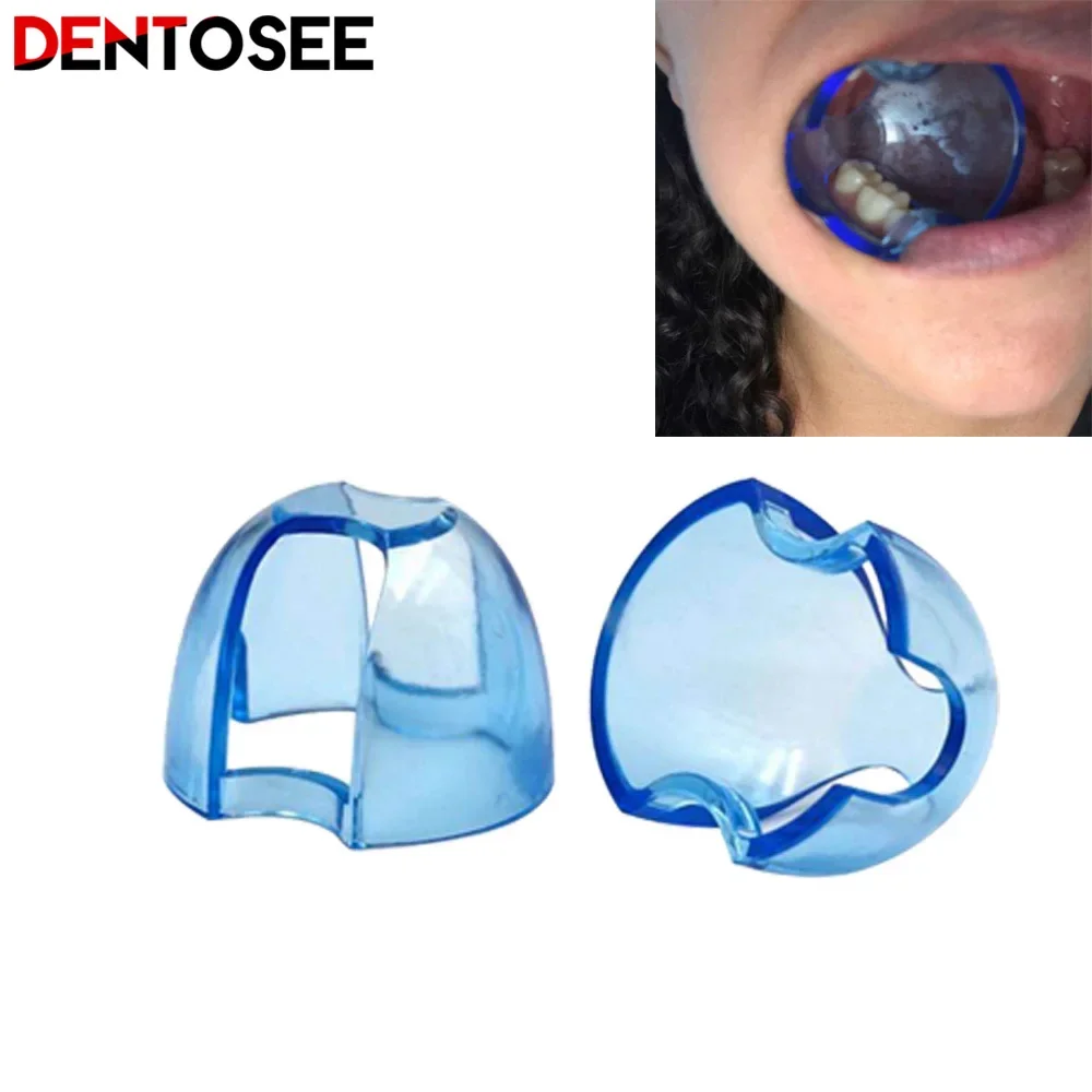 Teeth Whitening Zoom - Dental Intraoral Cheek Retractor Lip Mouth