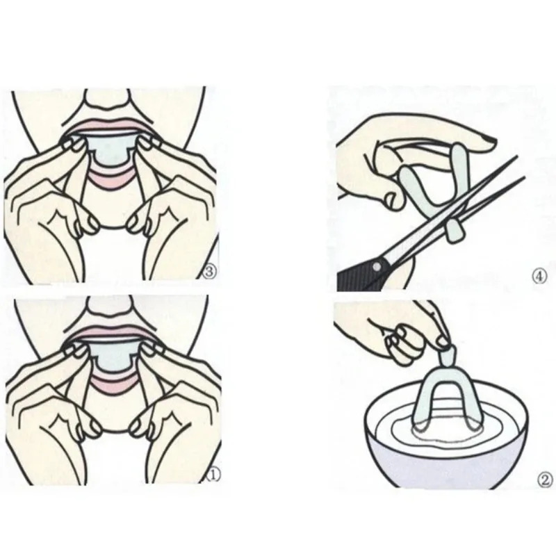 1/3/6pairs Silicone Mouth Guar - Teeth Whitening Gel For Trays avaliação e preço