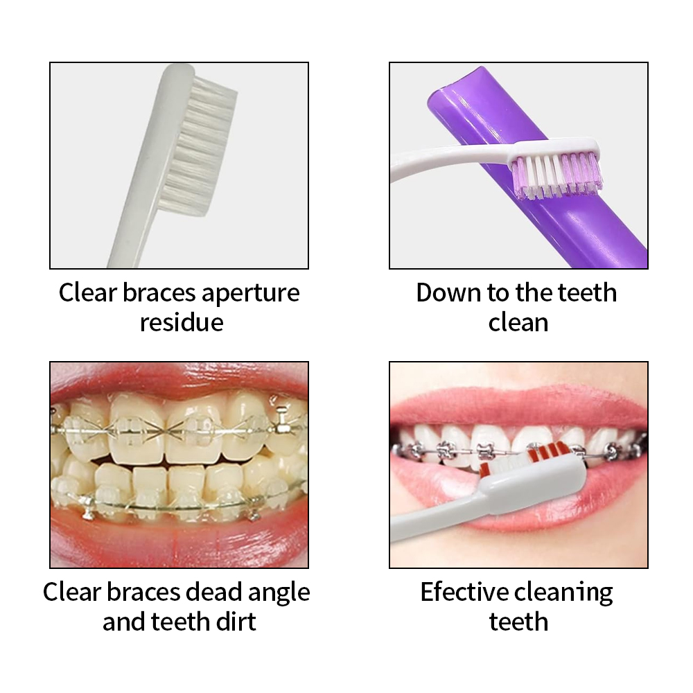 8Pcs/set Orthodontic Dental Ca - Teeth Whitening For Braces avaliação e preço