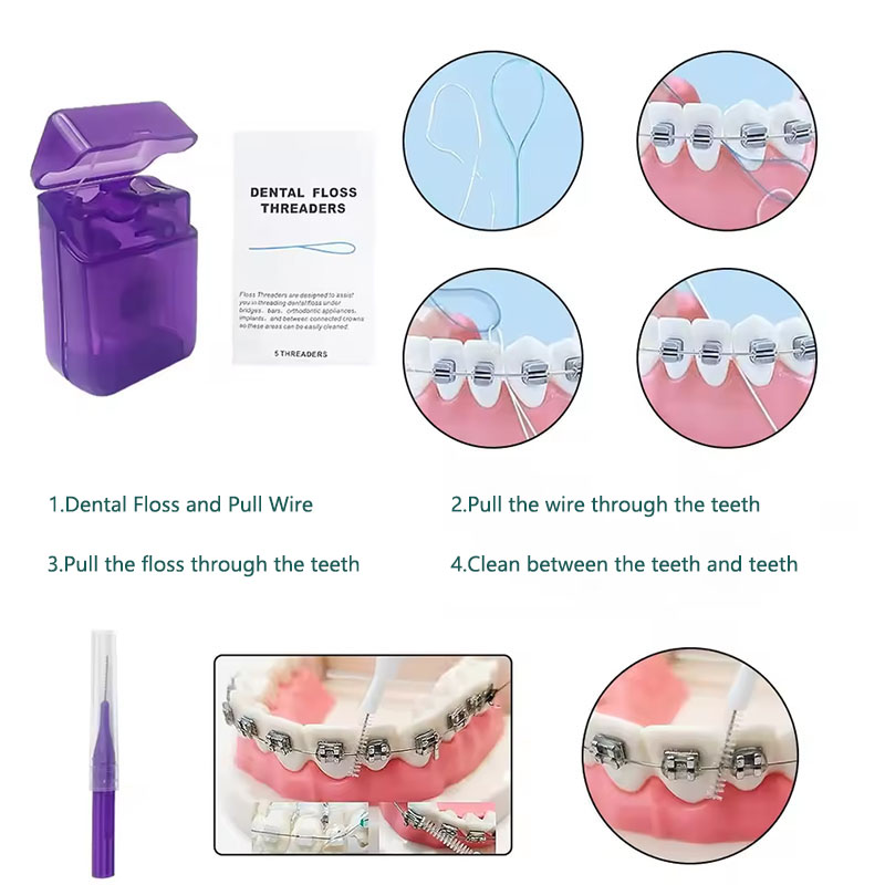 1set Orthodontic Dental Oral C - Teeth Whitening For Braces avaliação e preço
