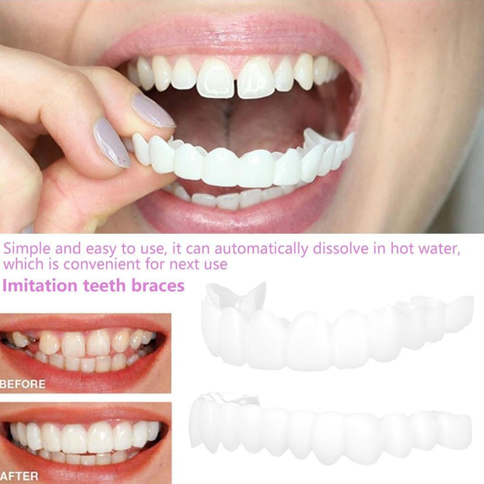 Dental Upper Lower Fake Teeth  - Teeth Whitening For Braces avaliação e preço