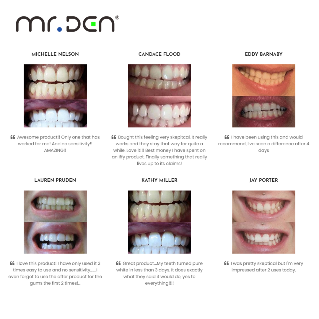 Dr. Whiten 3 Pack Teeth Whiten - Teeth Whitening Kit Professional avaliação e preço