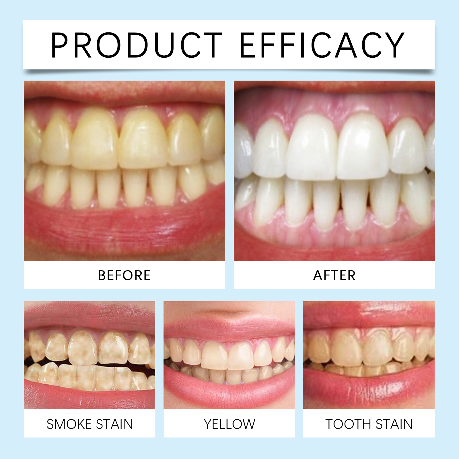 Oralhoe Nicotinamide Whitening - Teeth Whitening Toothpaste avaliação e preço