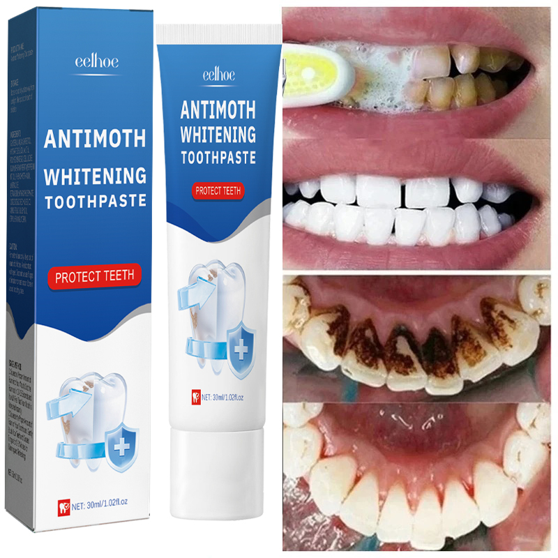 Fast Remove Smoke Stains Tooth - Teeth Whitening Fast avaliação e preço
