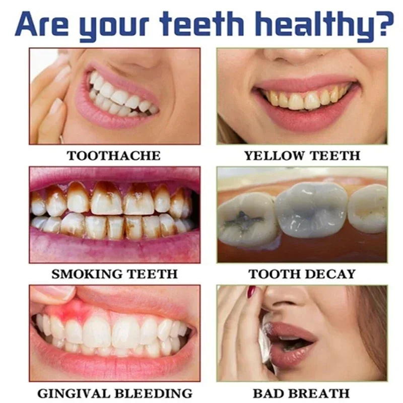 Fast Remove Smoke Stains Tooth - Teeth Whitening Fast avaliação e preço