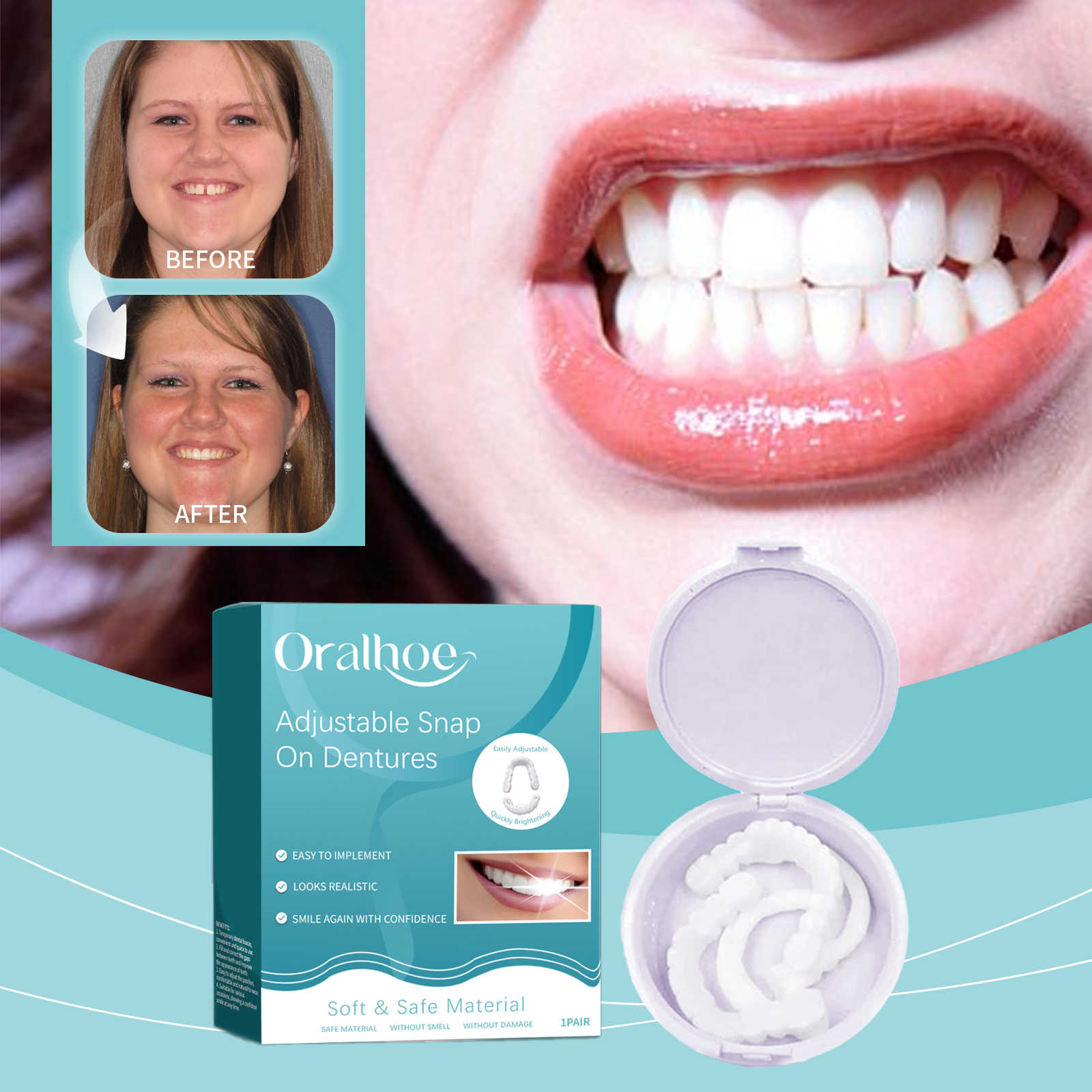 Pop ite Cover Whitening Interd - Teeth Whitening For Braces avaliação e preço