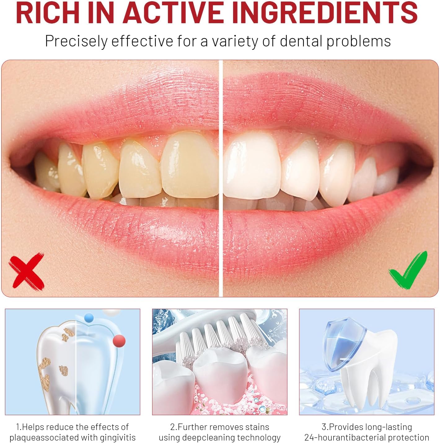 Niacinamide Whitening Toothpas - Teeth Whitening Best avaliação e preço