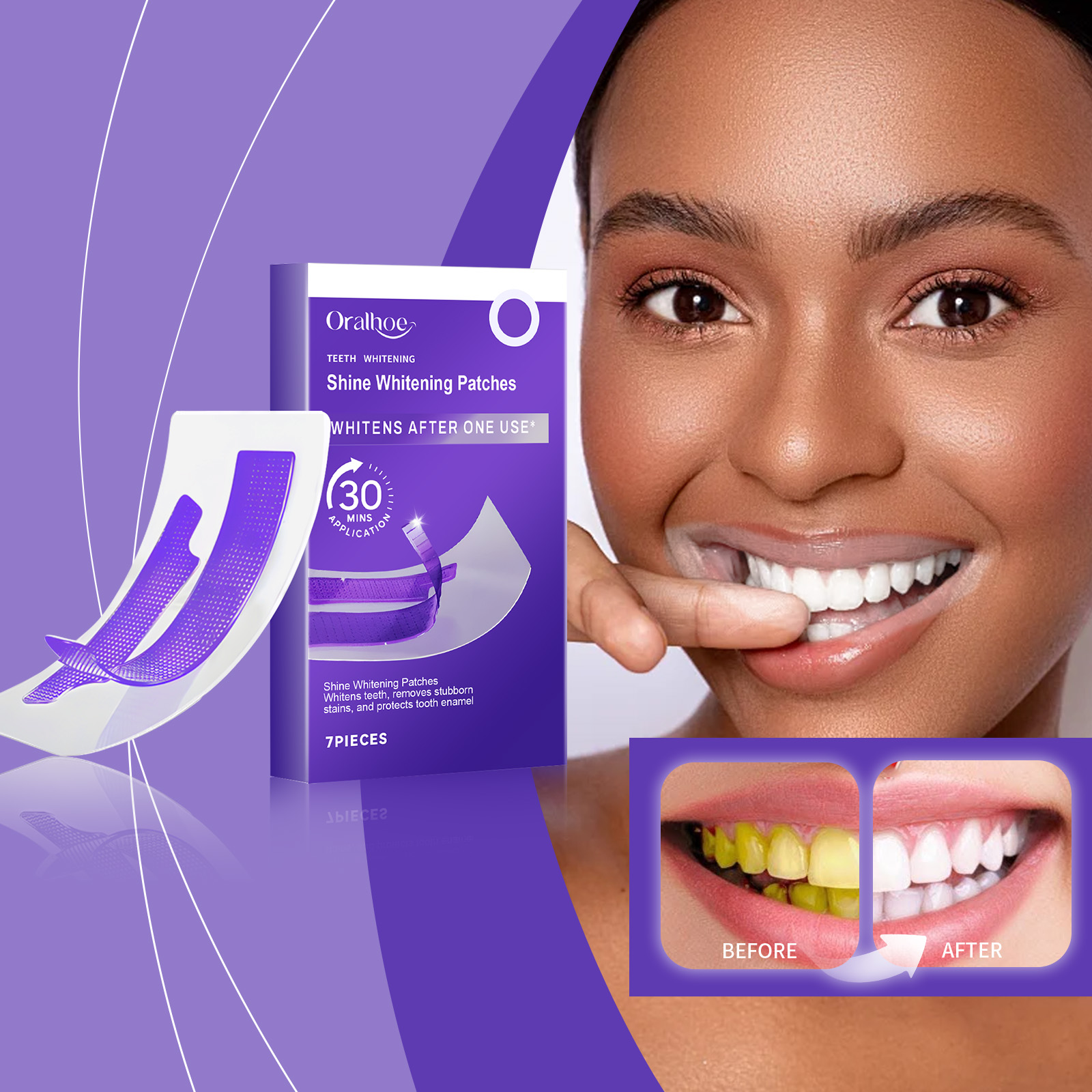 Purple Teeth Whitening Strips  - Teeth Whitening Retainer avaliação e preço