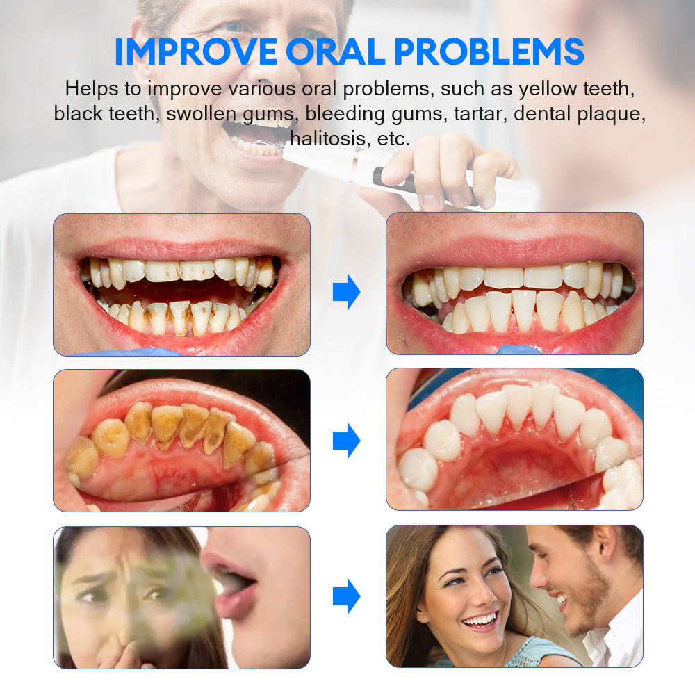 Electric Ultrasonic Dental Sca - Teeth Whitening Express avaliação e preço