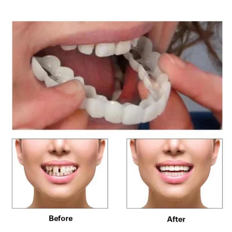 Best Sellers  Teeth Kit Fake T - Teeth Whitening Session avaliação e preço