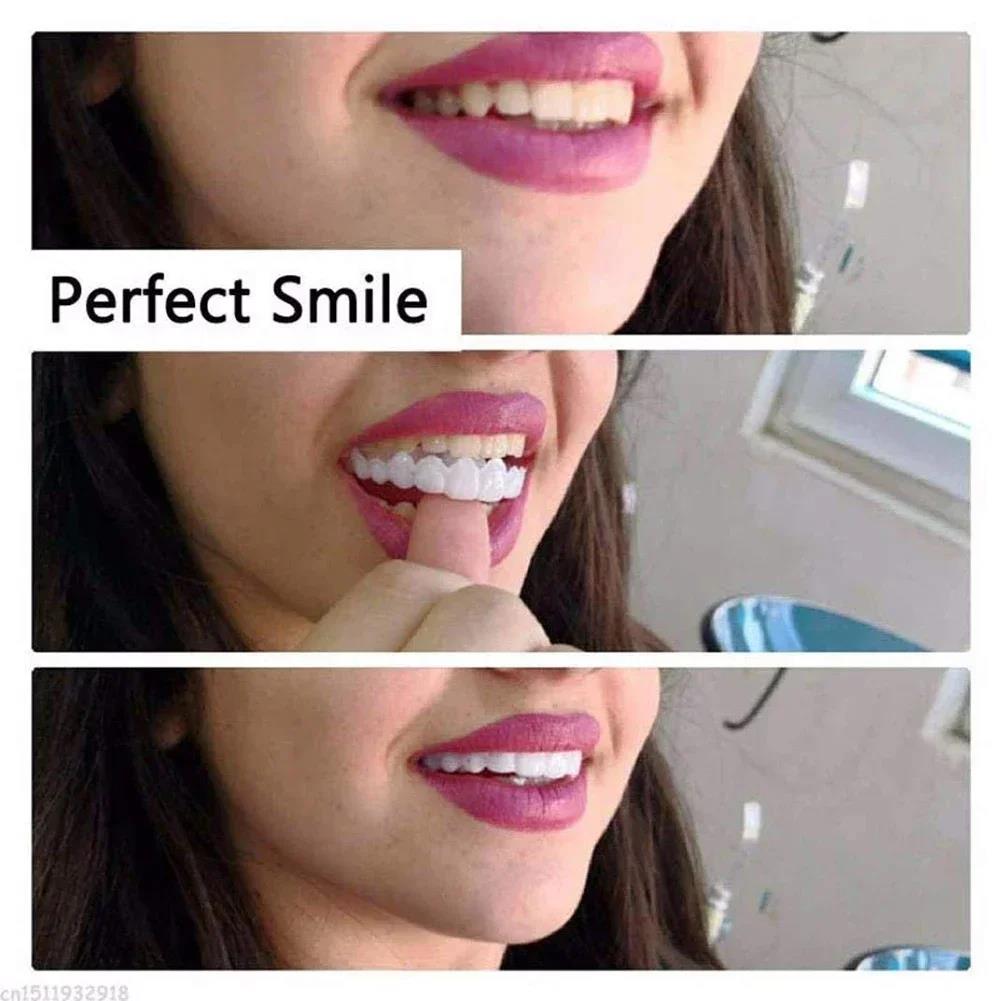 Best Sellers  Teeth Kit Fake T - Teeth Whitening Session avaliação e preço