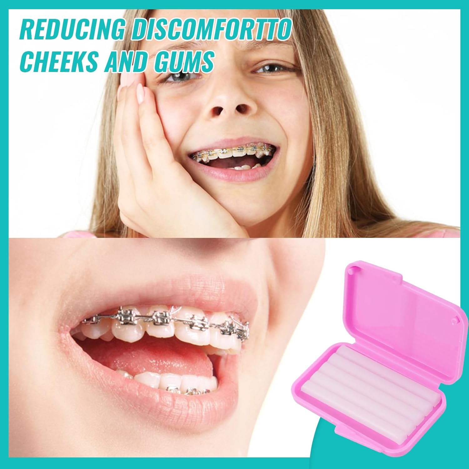 10box Dental Orthodontic Relie - Teeth Whitening For Braces avaliação e preço