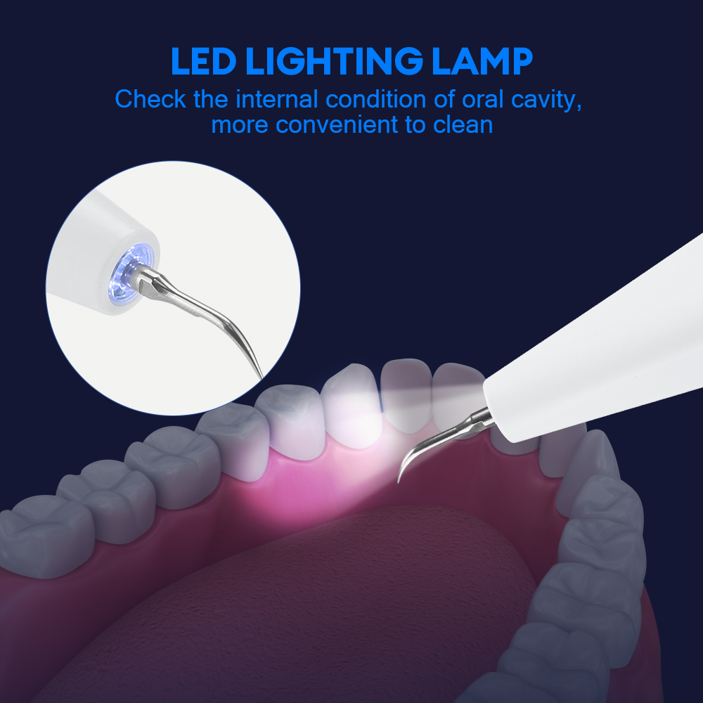Ultrasonic Dental Calculus Rem - Teeth Whitening Express avaliação e preço