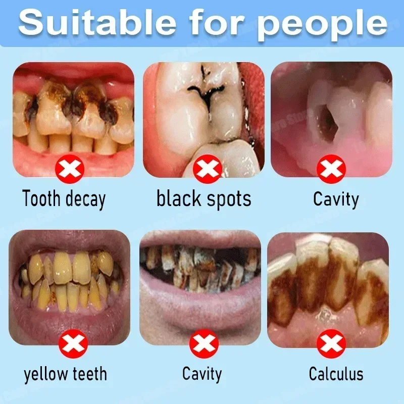 Anti Decay Toothpaste repairs  - Teeth Whitening Best avaliação e preço