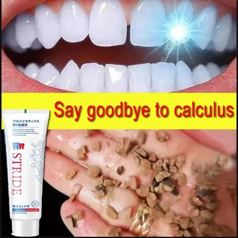 Dental Calculus Remover Remova - Teeth Whitening Best avaliação e preço