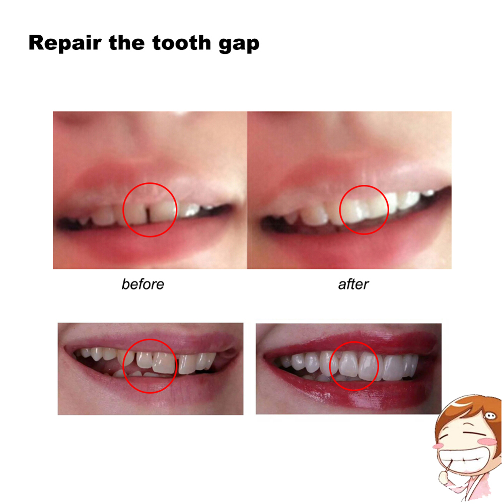 10/100g Dental Glue Handmade S - Teeth Whitening Session avaliação e preço