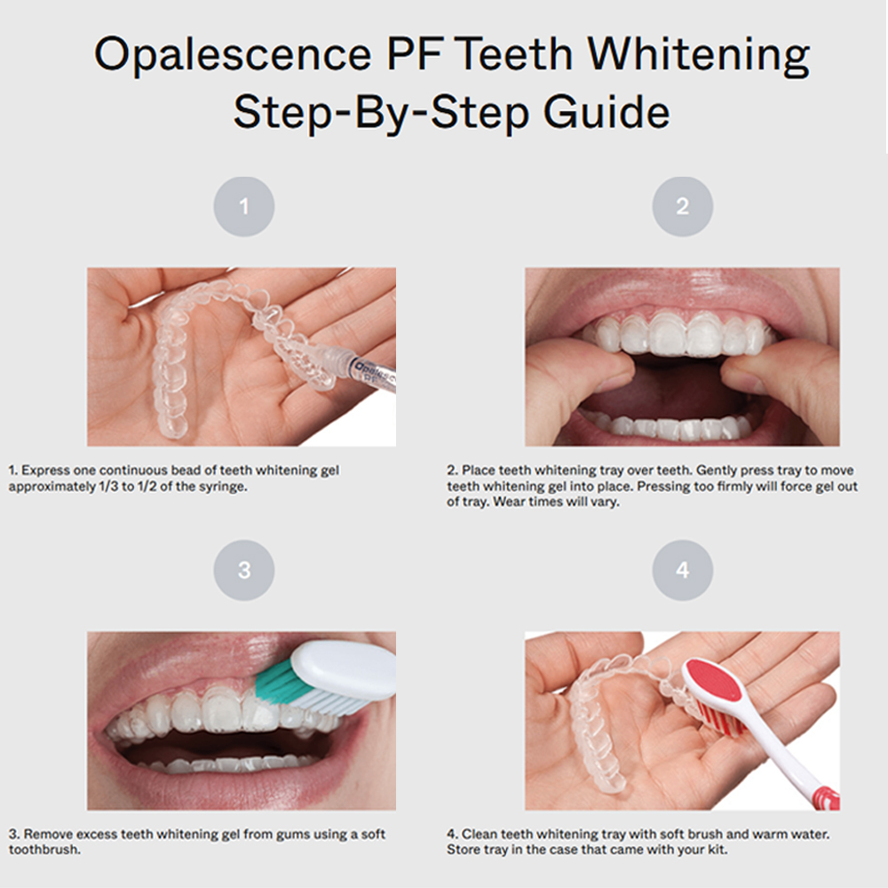 opalescence pf 15% refill kit  - Teeth Whitening Gel Opalescence avaliação e preço