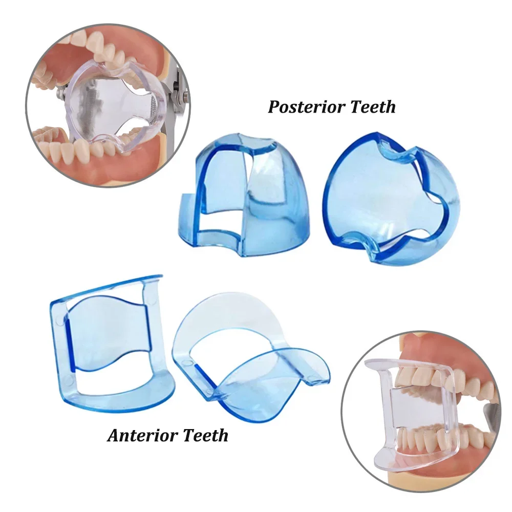 Dental Intraoral Cheek Retract - Teeth Whitening Zoom avaliação e preço