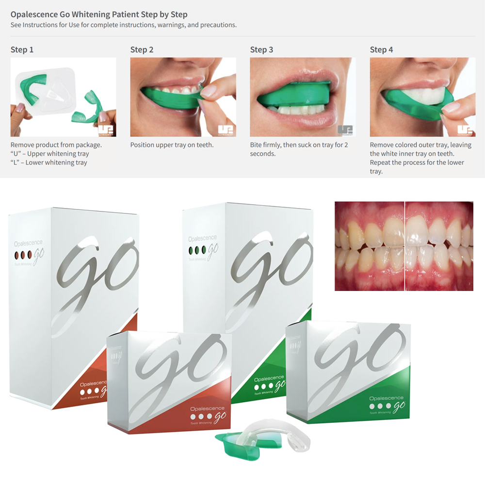 Opalescence Go Teeth Whitening - Teeth Whitening Gel Opalescence avaliação e preço