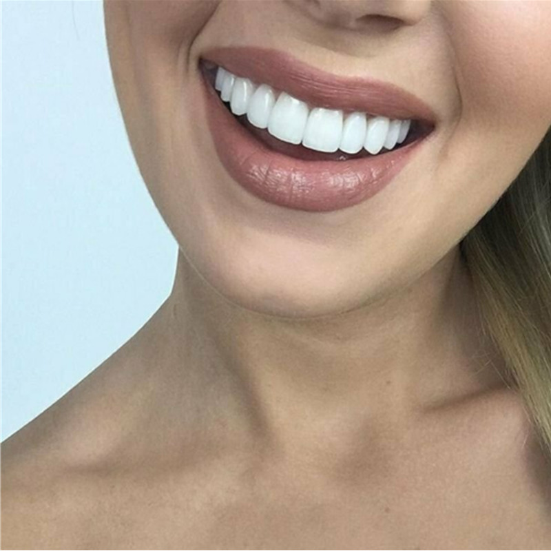 Whitening Teeth Veneers Tempor - Teeth Whitening For Braces avaliação e preço