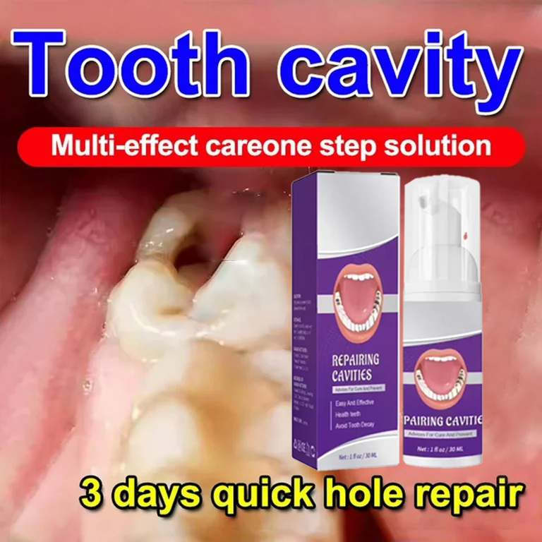 Teeth Cleaning Toothpaste Remo - Teeth Whitening Best avaliação e preço
