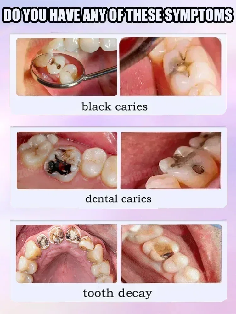 Teeth Cleaning Toothpaste Remo - Teeth Whitening Best avaliação e preço