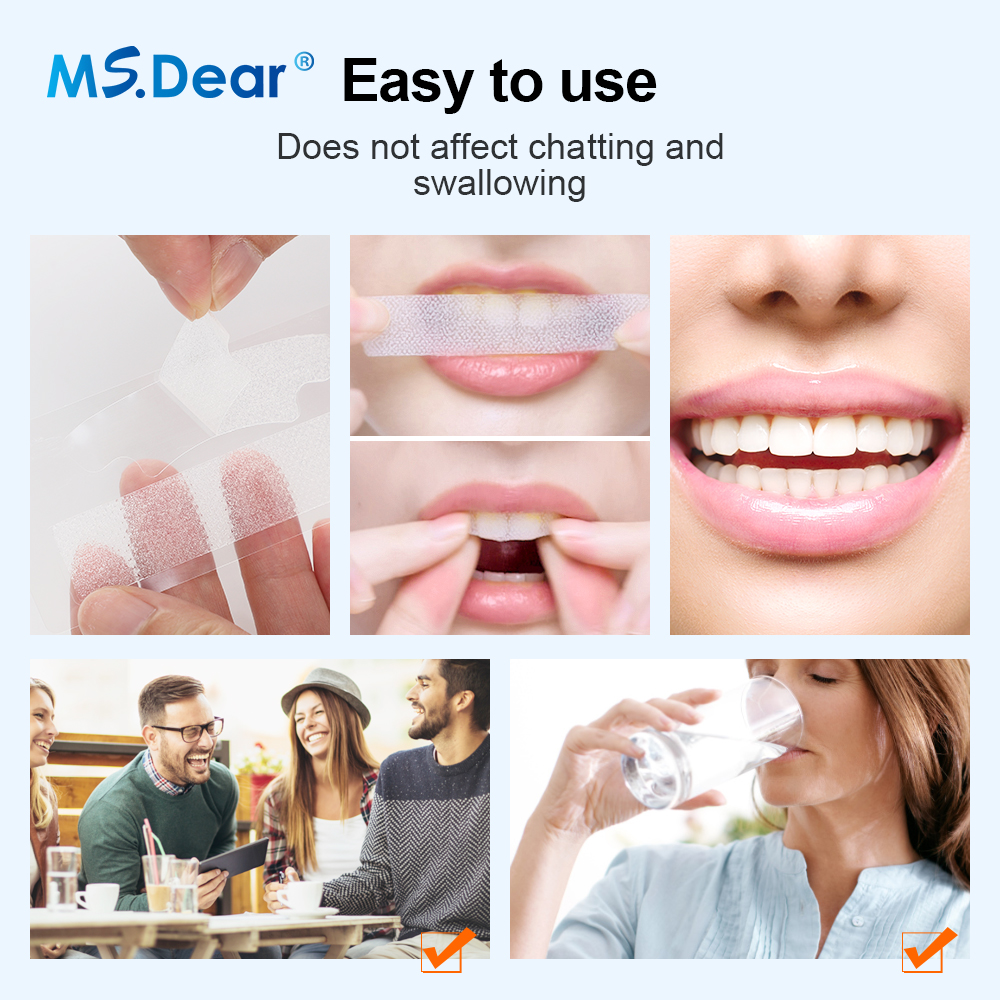 Teeth Whitening Strips Cleansi - Teeth Whitening Retainer avaliação e preço